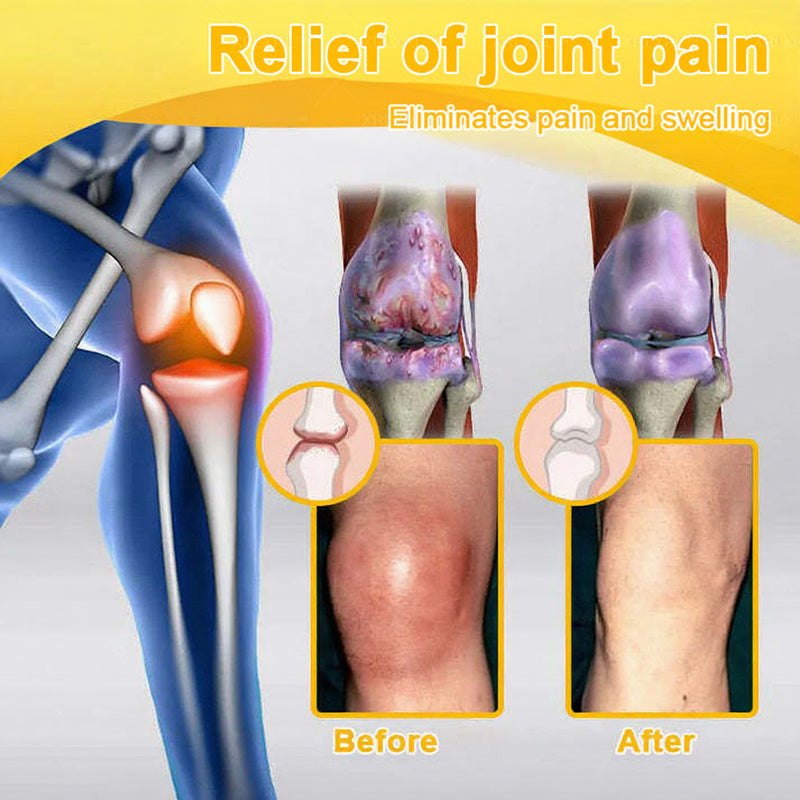 Jorondy® Bee Venom Pain-Relief Bone Healing Spray🐝🐝(Specially for older adults & AAOS recommends)
