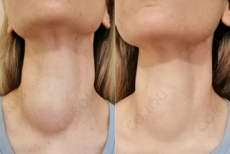 COROU® Natural Herbal Tourmaline Far Infrared Foot Patches 21 gempages 567118433360020521 d2d281dd bfc9 4e33 9520 fdbd3e56c6cd