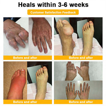 Upgrade to the Full Healing Plan! Congratulations on getting an extra 35% discount!